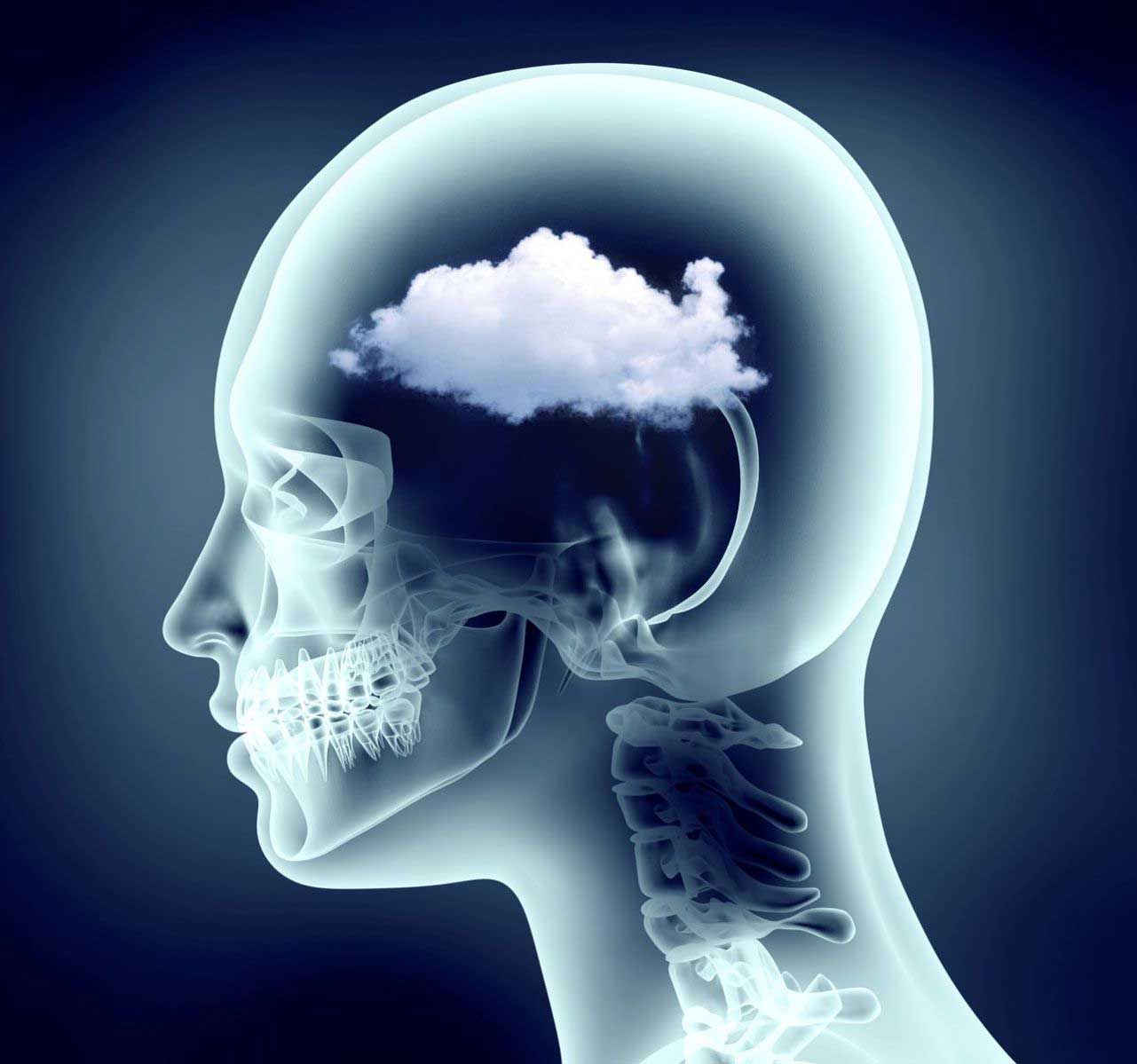 What Is Brain Fog?