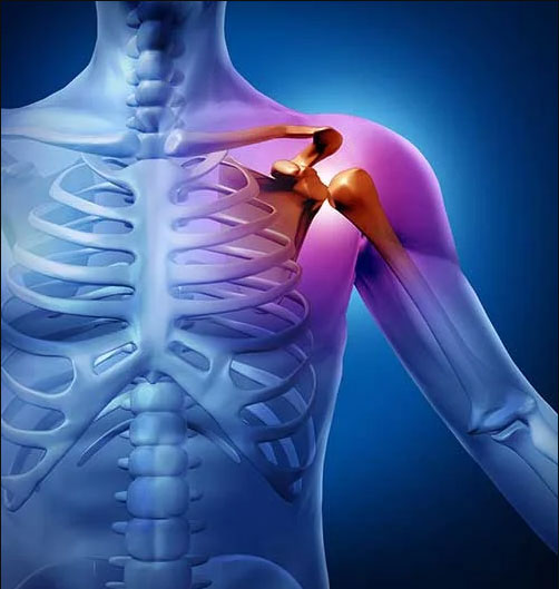 BROKEN COLLARBONE SYMPTOMS