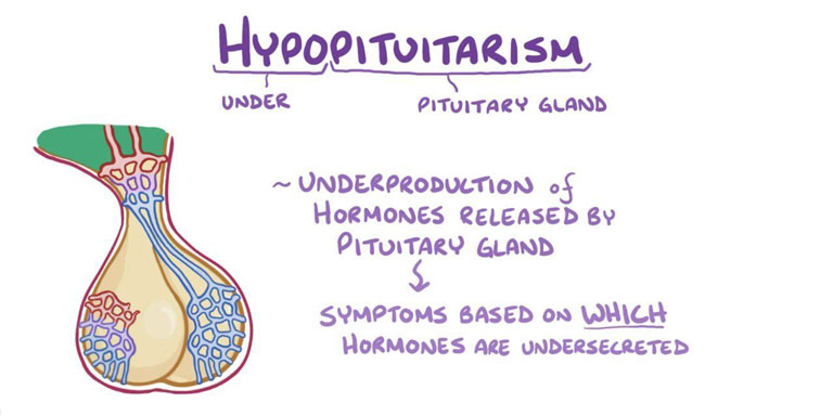 HYPOPITUITARISM 