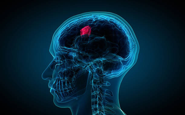 WHAT ARE SOME TYPES OF BRAIN SURGERY?