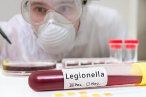 Legionnaires Disease Cause and Treatment