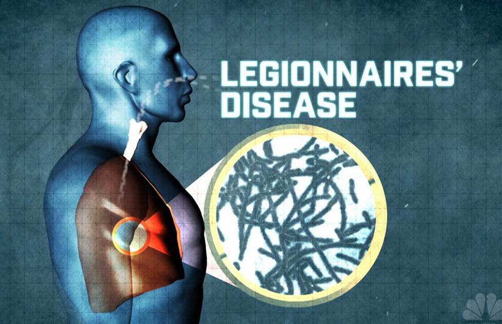 legionnaires disease treatment