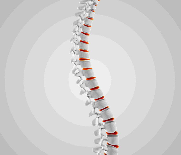 SPINE PAIN SYMPTOMS