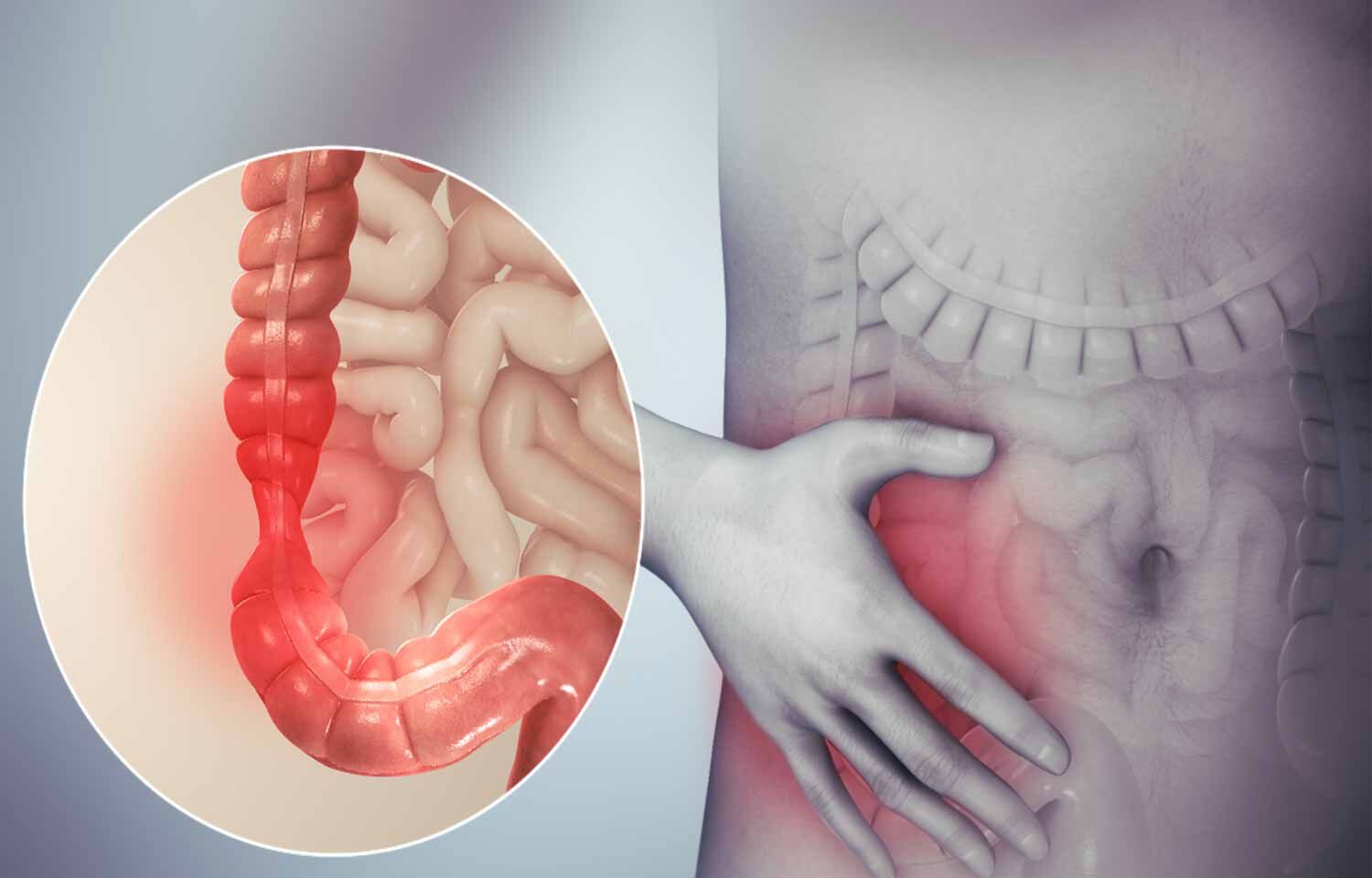 causes of functional pain syndrome