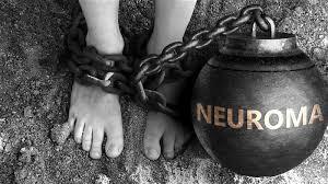 MORTON’S NEUROMA TREATMENT