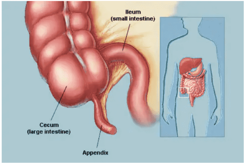 appendicitis pain location