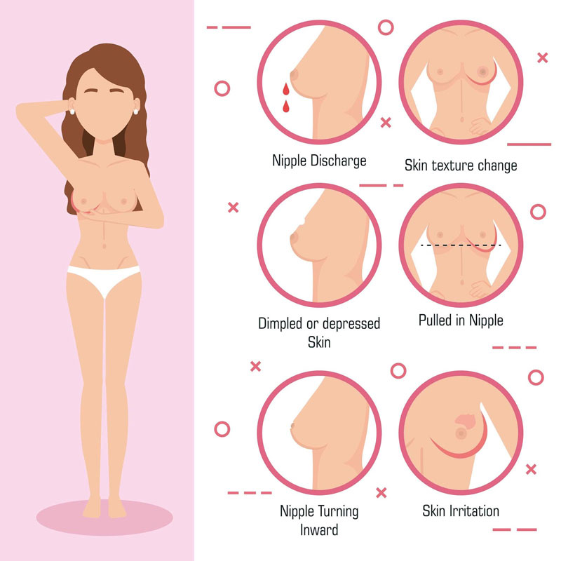 breast pain symptoms