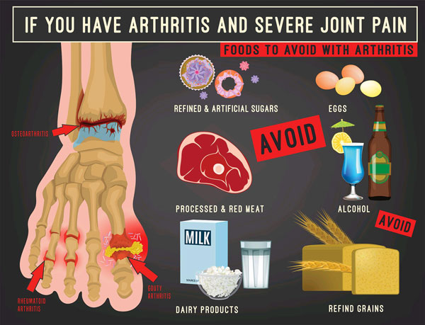 WHAT FOODS TO AVOID JOINT PAIN?
