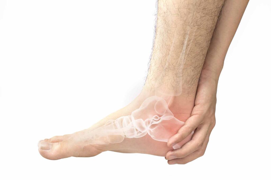 WHAT ARE COMMON MEDICAL FOOT CONDITIONS?