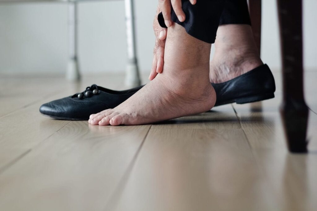 CAUSE AND SYMPTOMS OF FOOT CANCERS