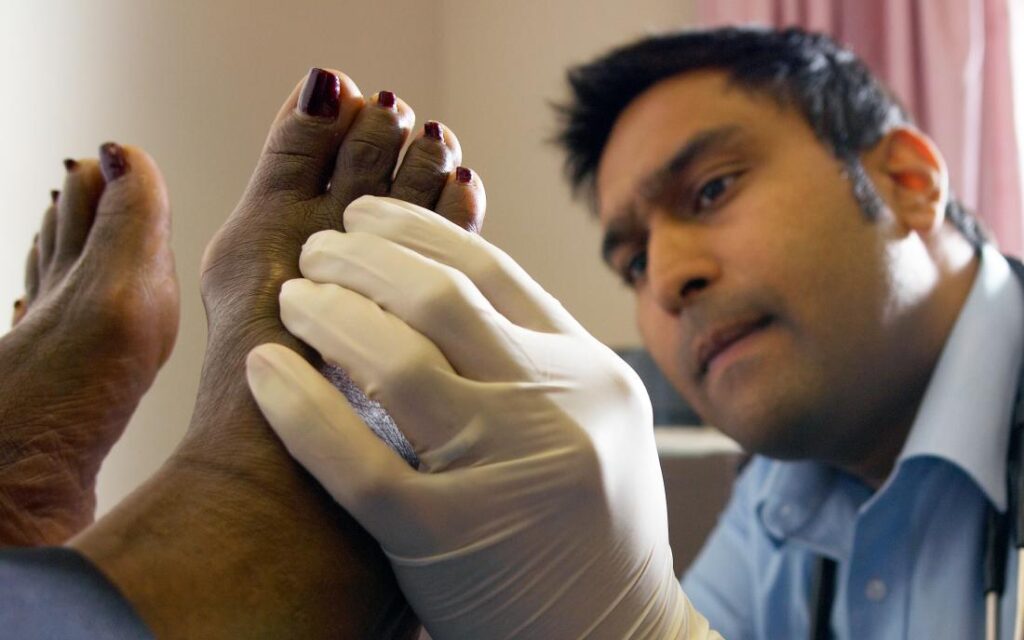 TREATMENT OF FOOT CANCER