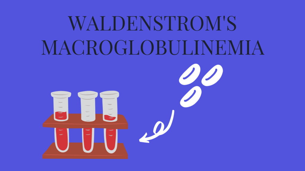 waldenstrom macroglobulinemia treatment