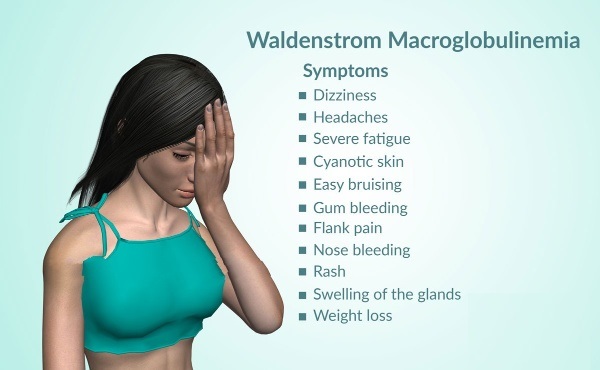 Waldenstrom Macroglobulinemia Symptoms