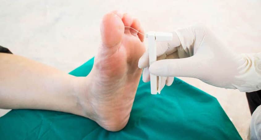 treatment for charcot foot