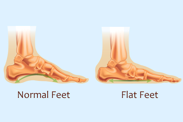 foot surgery