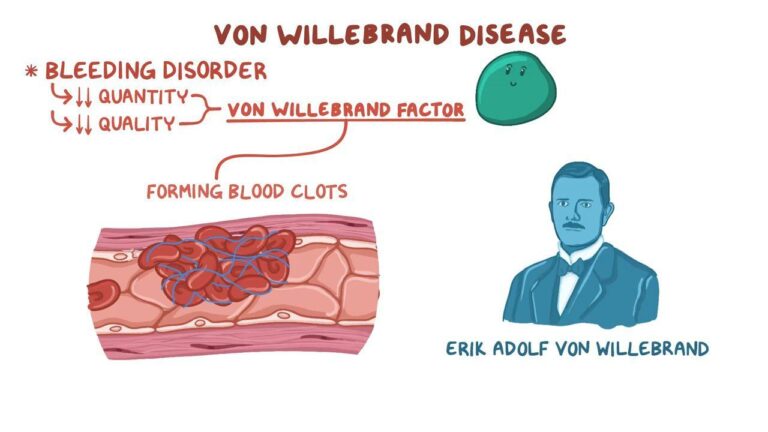 Willebrand Disease