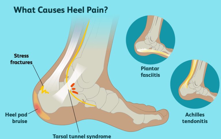 Itch caused due to nerves