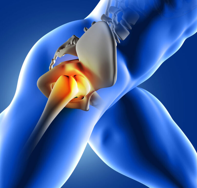 https://blogs.specialtycareclinics.com/types-of-hip-replacement-surgery/
