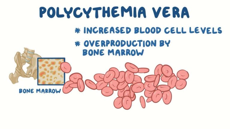 Polycythemia Vera