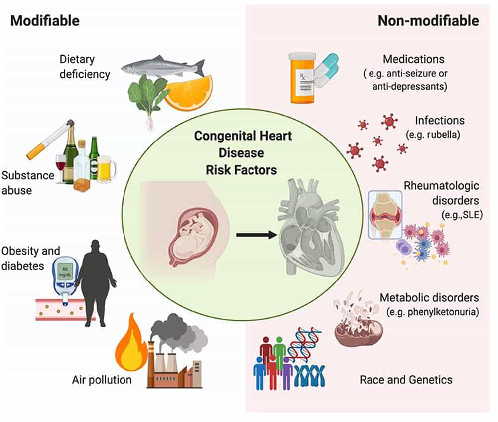 Congenital Heart Disease Risk Factors