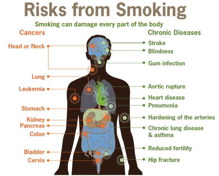 Risks Factors of Smoking