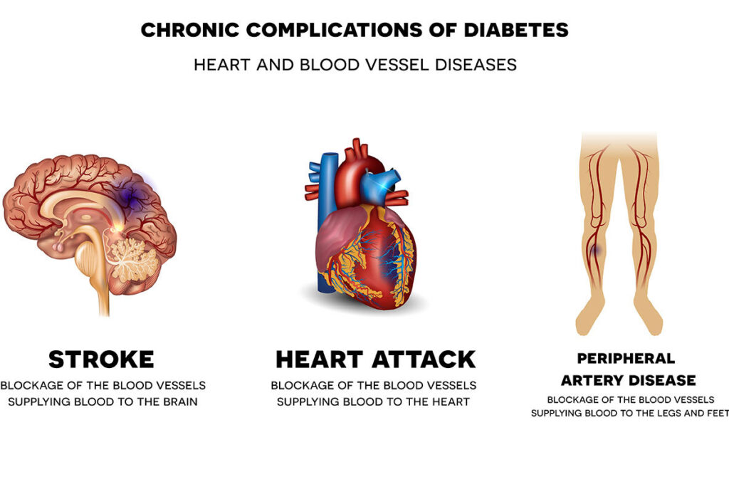 They Show 3 Chronic Complications of Diabetes