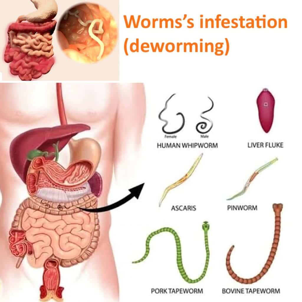 Worrm's Infection