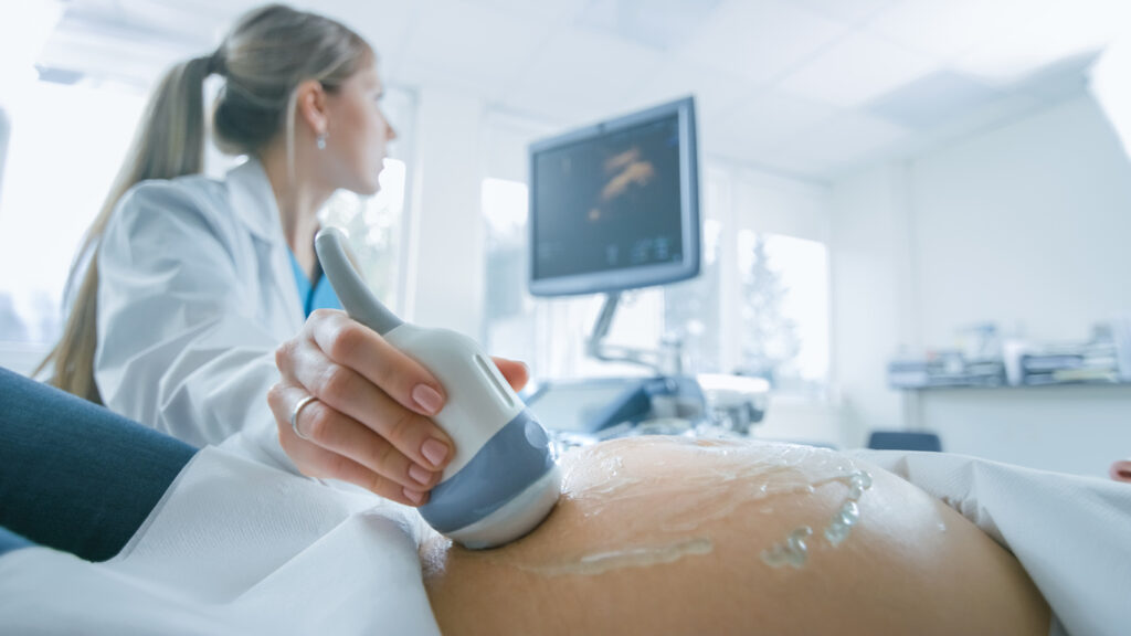 placenta accreta ultrasound