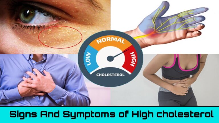 Symptoms of High Cholesterol