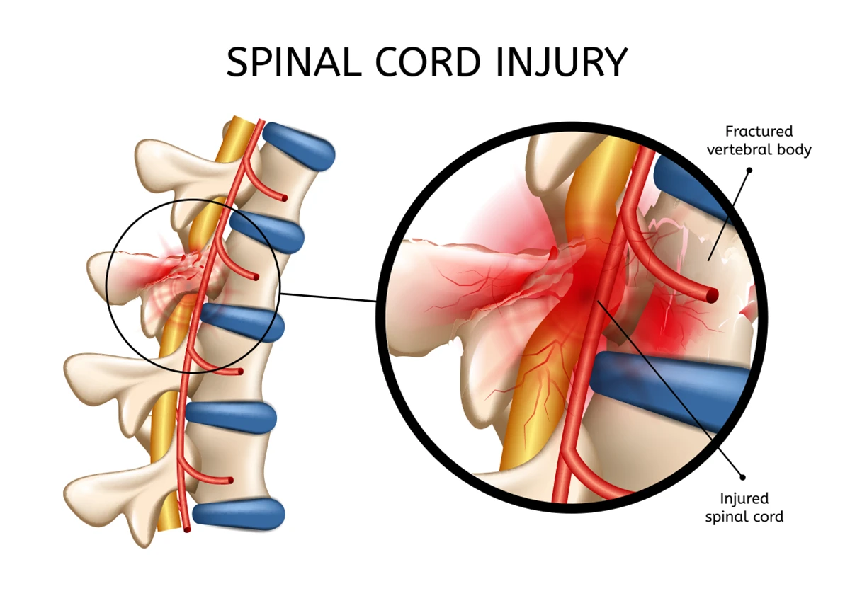 symptoms of spinal injury 