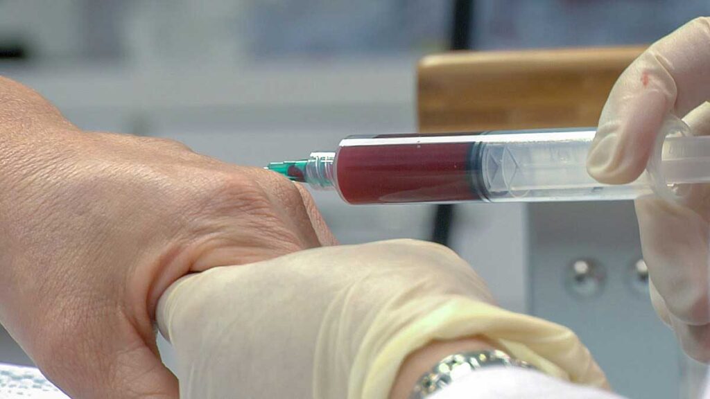 Platelet-rich plasma injection