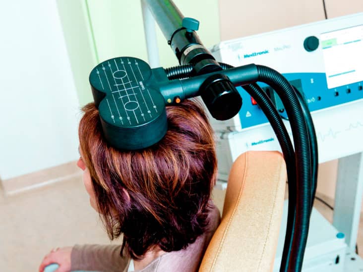 Transcranial Magnetic Stimulation