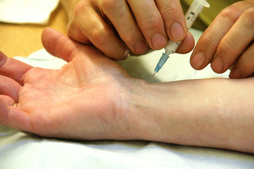 what are cortisone shots