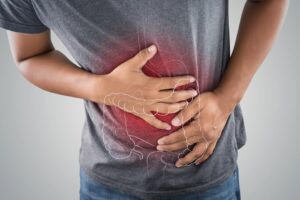 Link Between Post Covid Syndrome and Digestive Issues