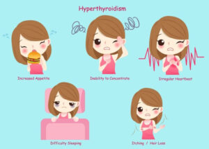 Hyperthyroidism: Symptoms, Causes and Treatments