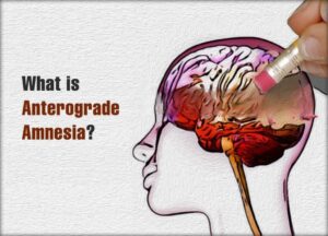 What is Anterograde Amnesia
