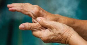 A new approach towards arthritis management