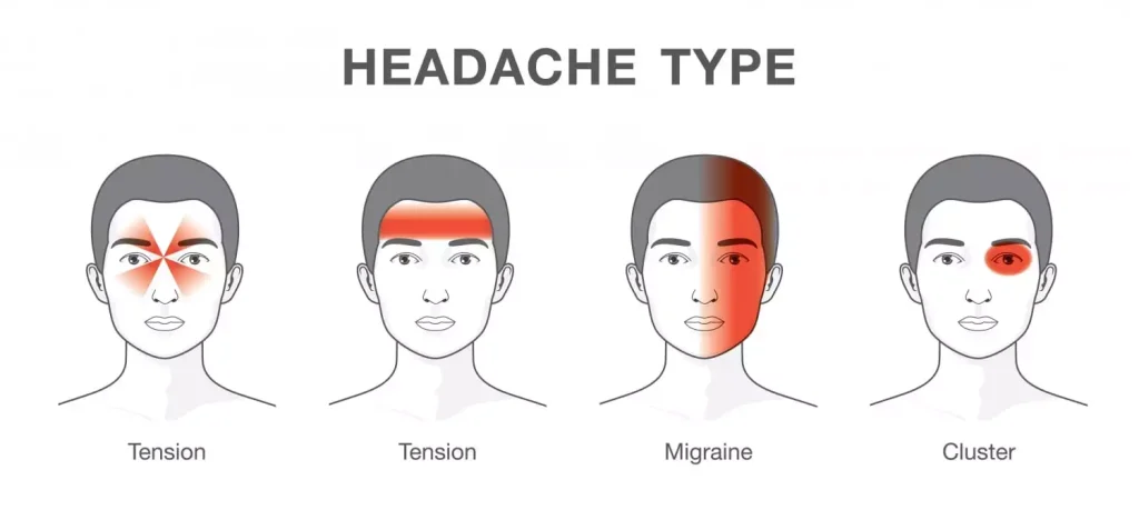 Types of Headache