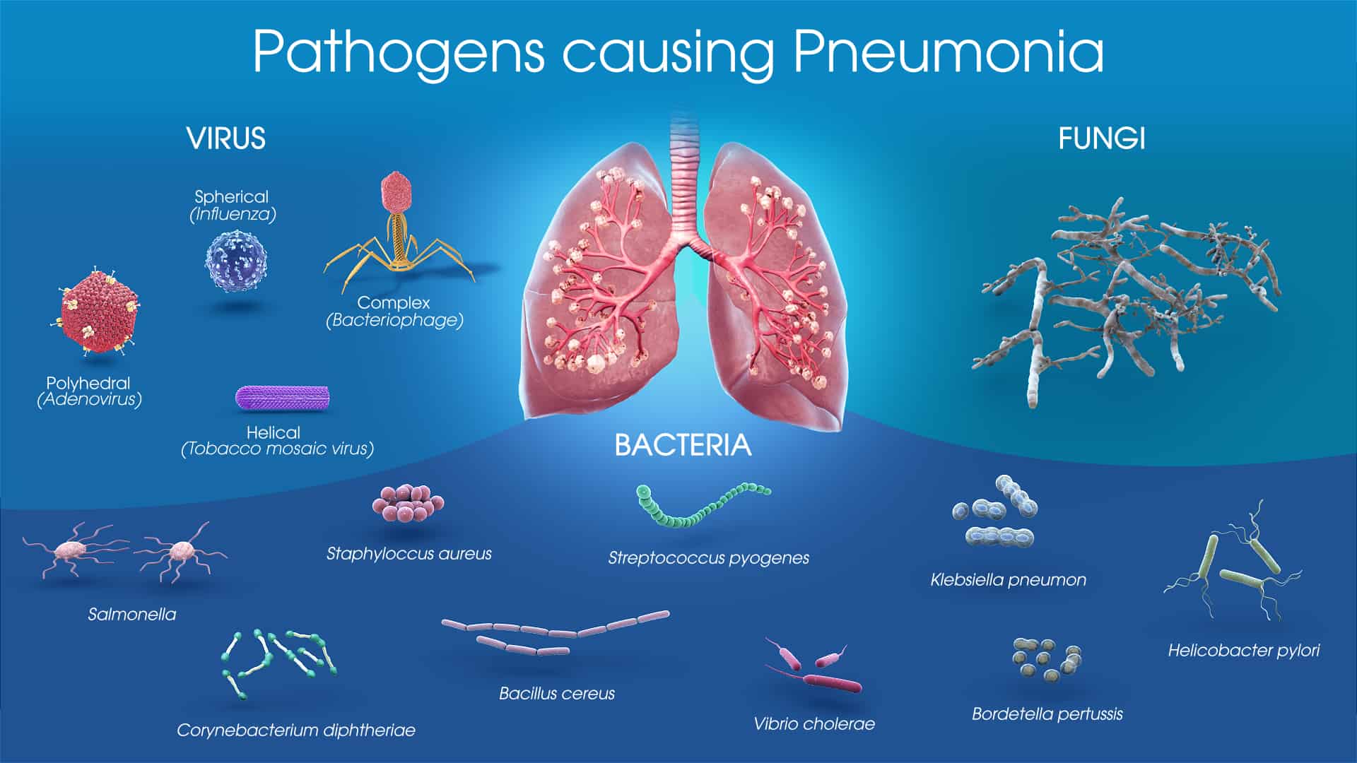Types of Pneumonia