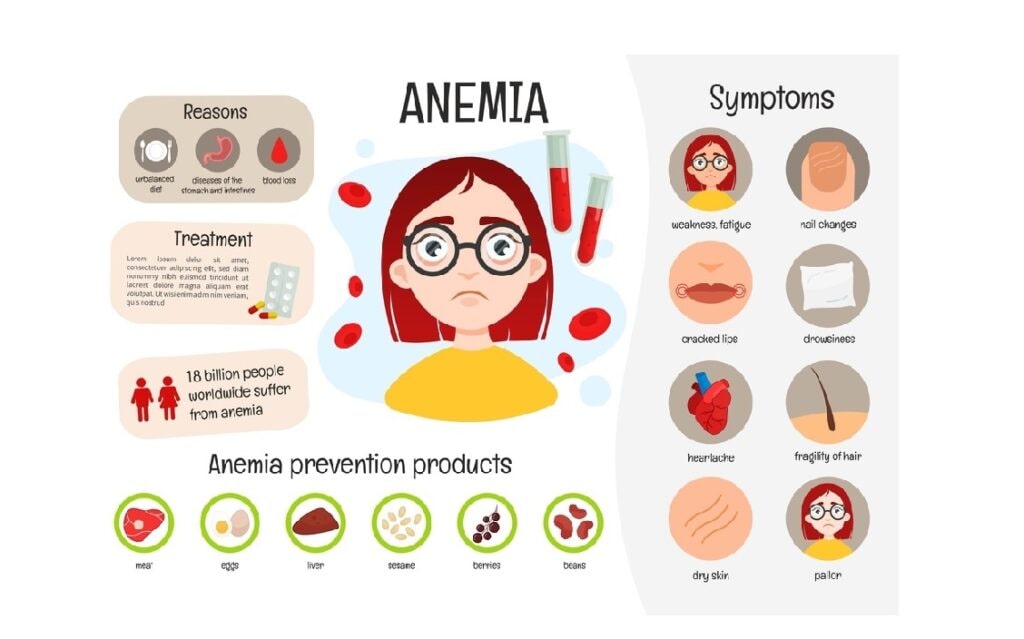 Signs and Symptoms of Anemia
