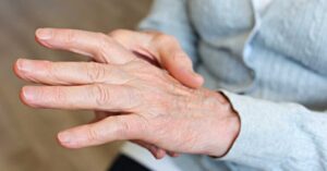 Coping mechanism for arthritis condition