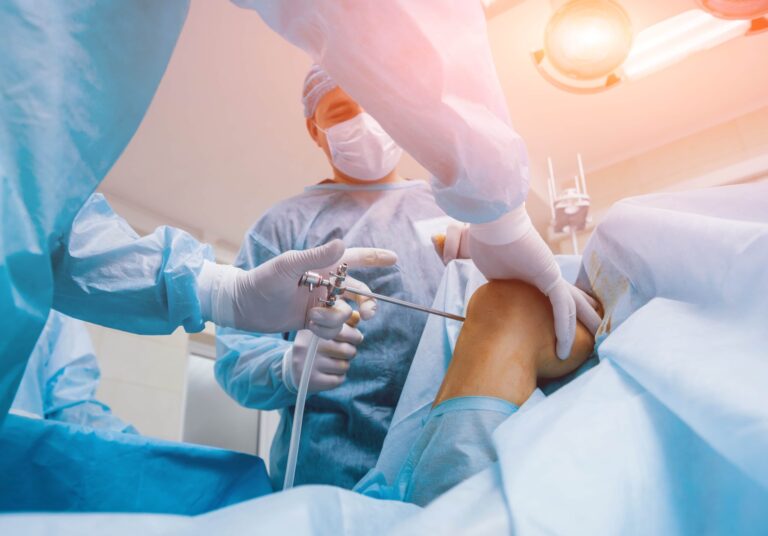 Arthroscopy Surgery