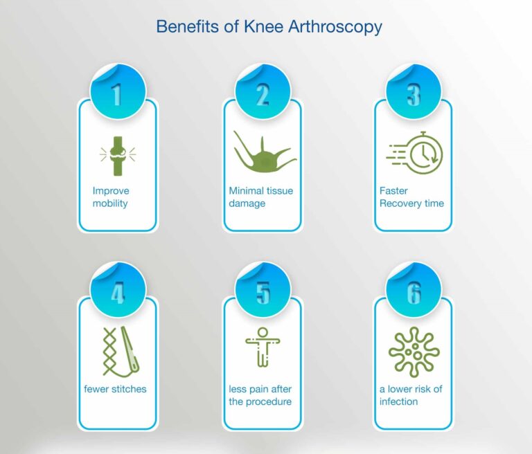 Benefits of Knee Arthroscopy