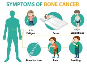 Bone Cancer Symptoms