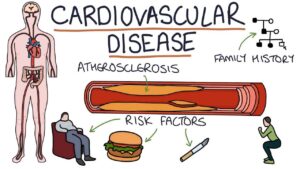 Learn How to Reduce Cardiovascular Disease