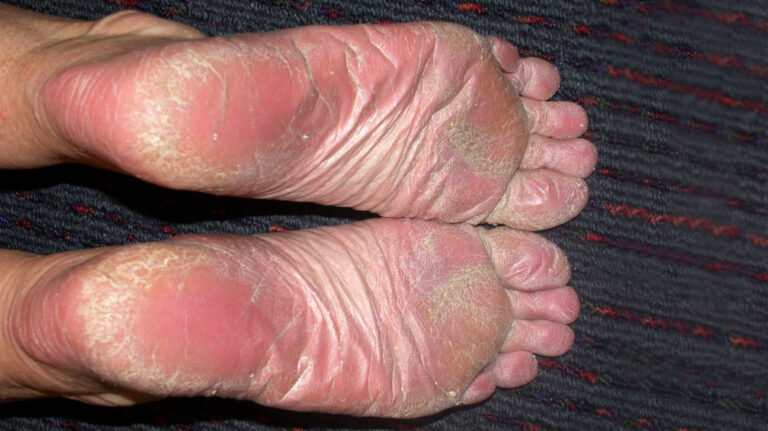 Triggering and Underlying Causes of Podiatry