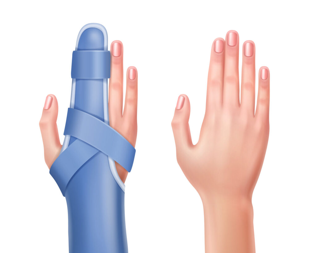 types of fingernail injury