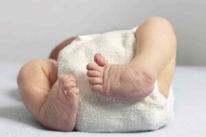 Being Born with Clubfoot
