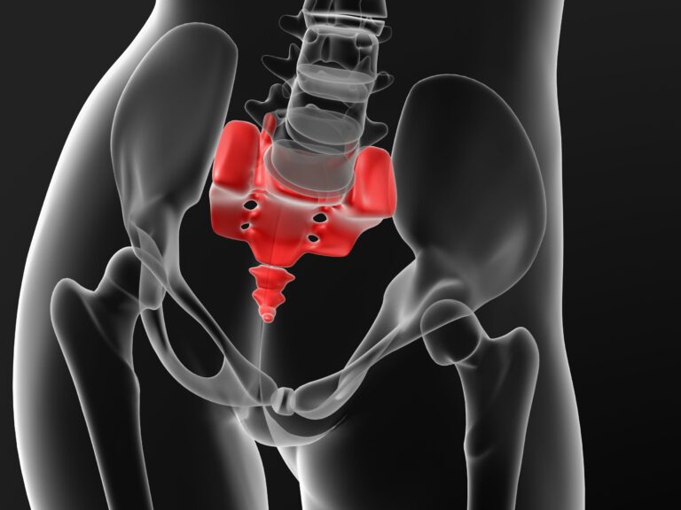 Coccyx Fracture