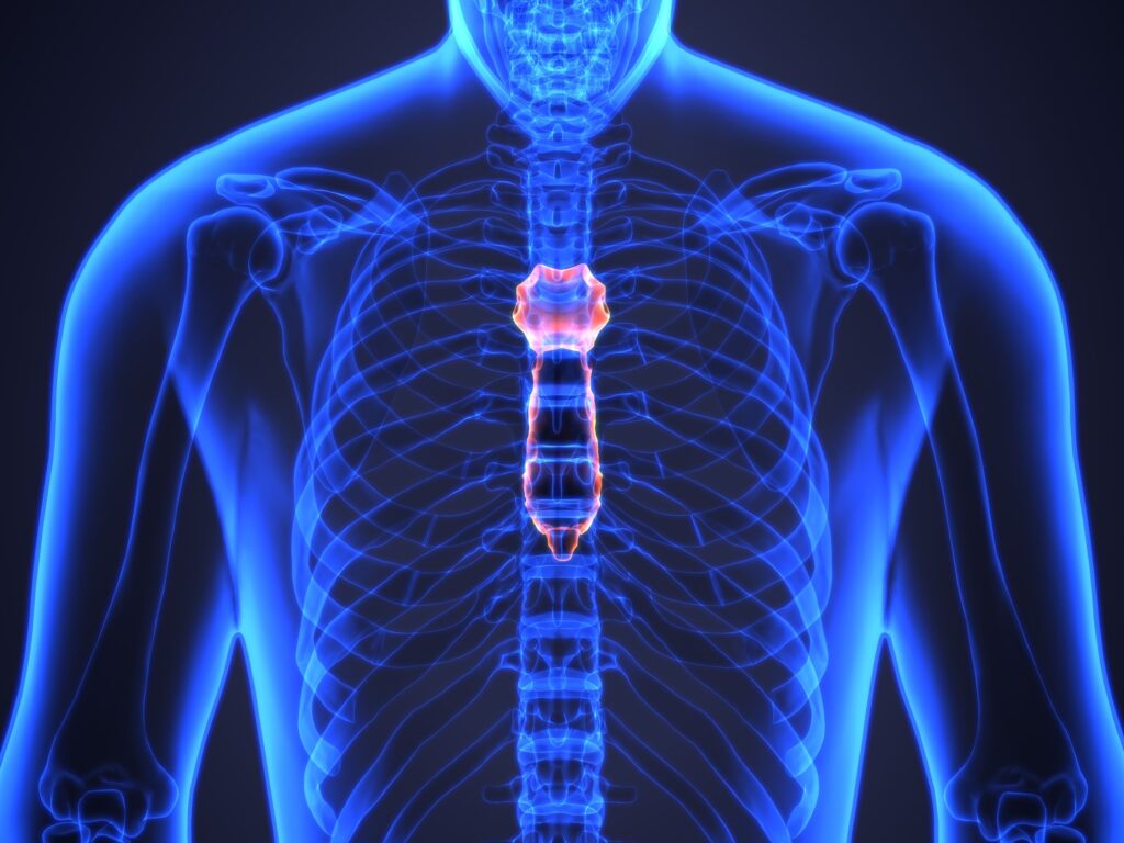 Costochondritis Diagnosis